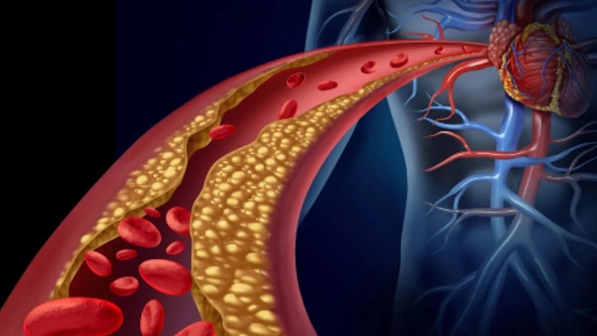 Health benefits of sweet potato know the details