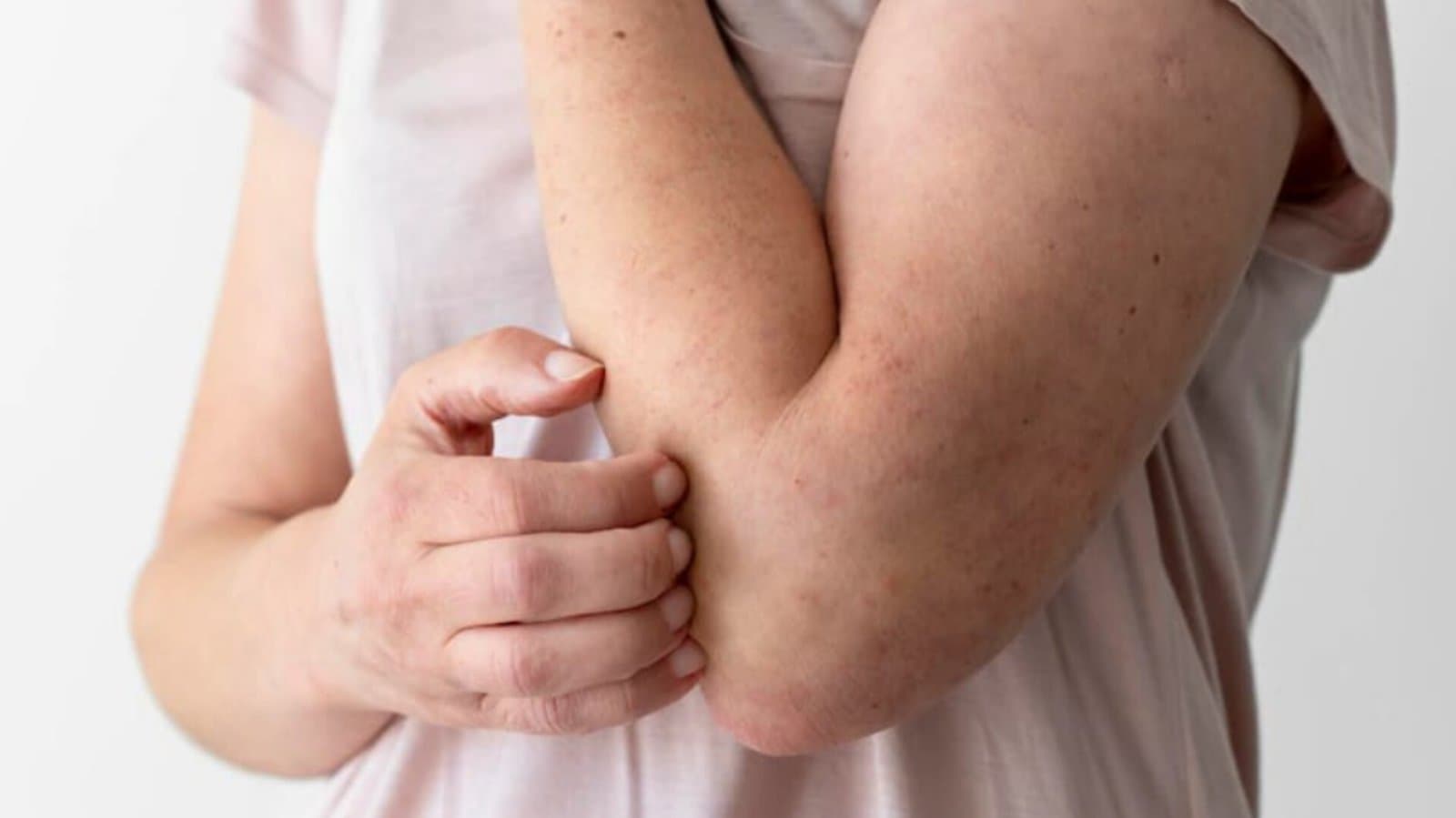 Deficiency of vitamin and minerals may cause skin disease like itchting and skin inflammation lif