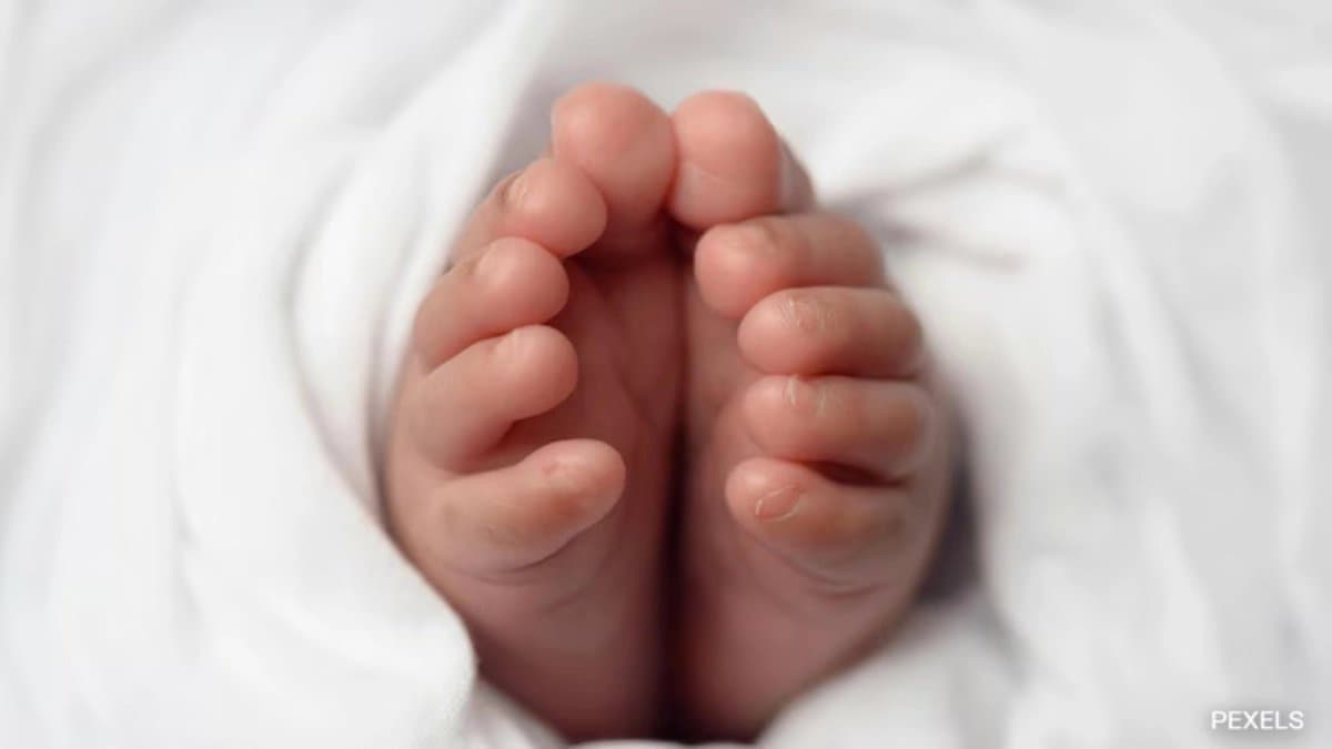 : Newborn in Karnataka discovered with twin growing inside