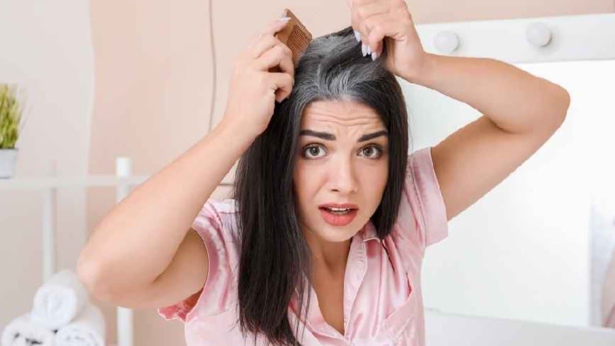  5 Best Foods That Increase Melanin Production And Prevent Grey Hair Effectively lif