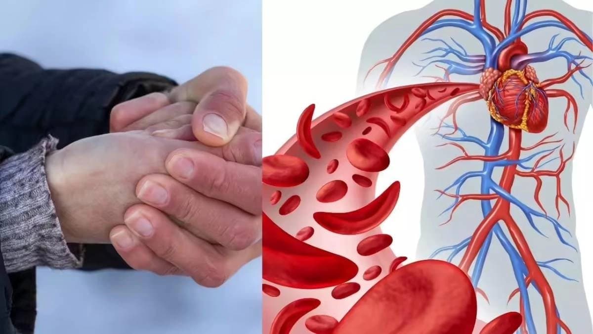 Health Tips: Cold hands and feet could be a serious warning sign