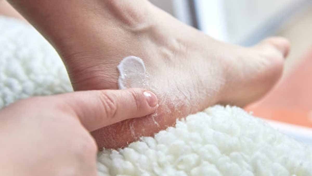 Cracked heels are healed by this home made natural cream make your heels soft and beautiful lif