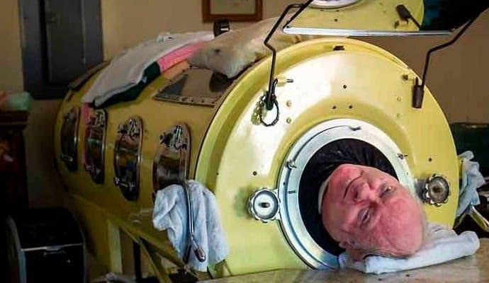 Polio-Infected Man Spent 70 Years Inside An Iron Lung, Dies 