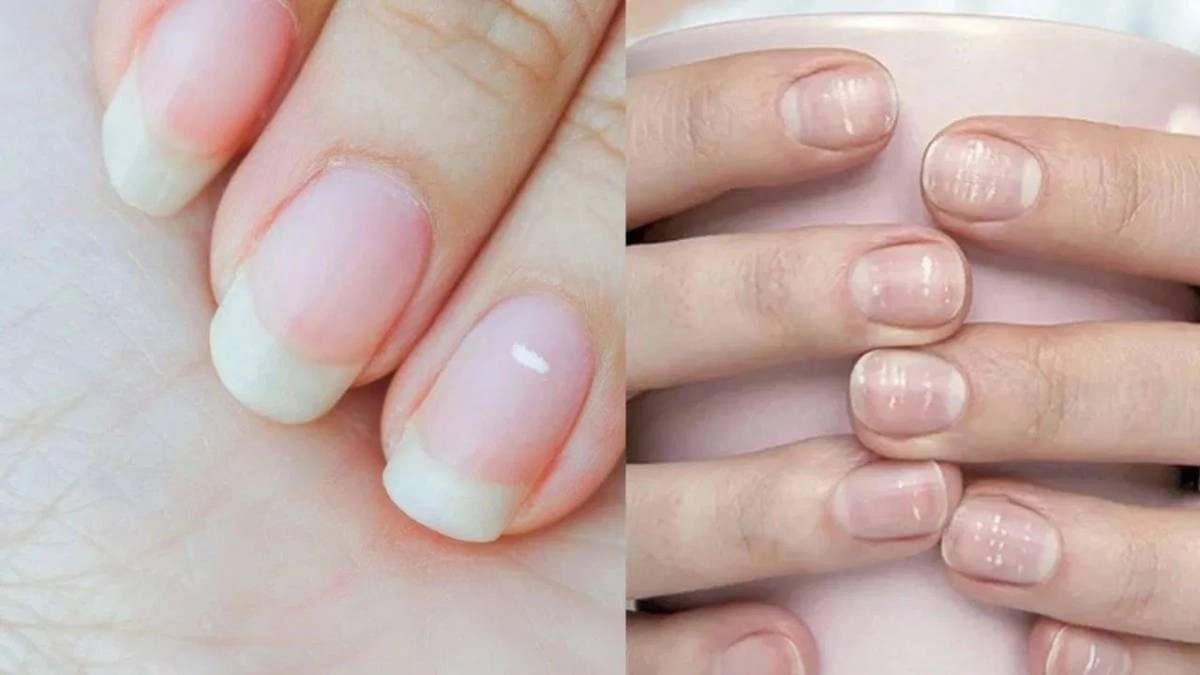  Health Tips These symptoms of nails can indicate critical health problems