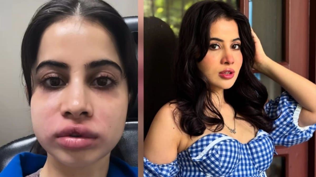 Urfi Javed shared her pictures of new face without fillers 