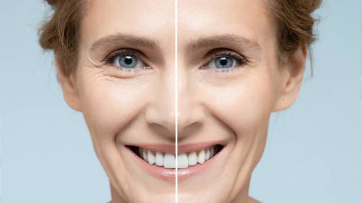  this home made natural anti aging face cream made by carrot which is rich with vitamin c is very effective for your skin and make it bright and shiny lif