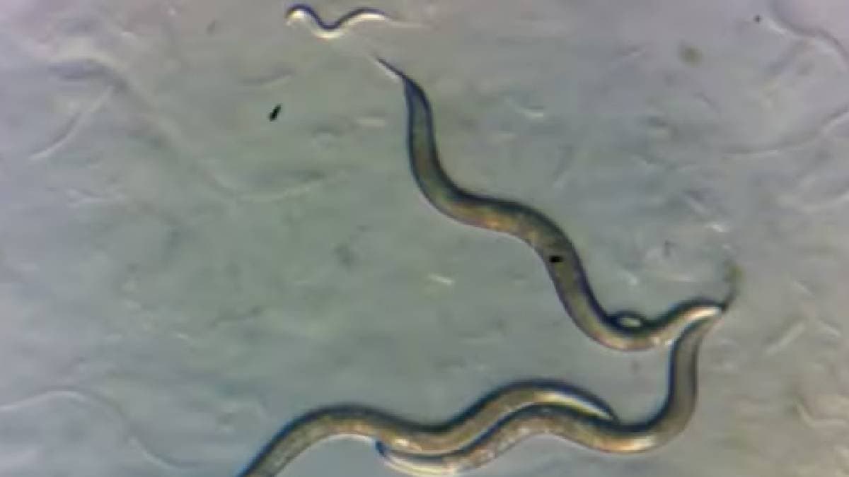 Tiny Worms Living In Chernobyl Can Offer DNA Repair Mechanism For Humans dna