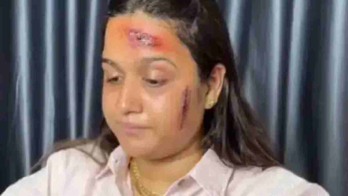  Fake Injuries  Trick To taking off from office viral video