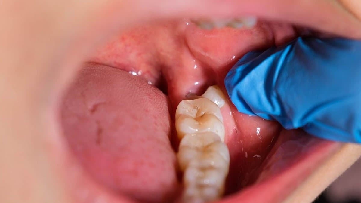 make your own toothpaste using three elements to strengthen your gum
