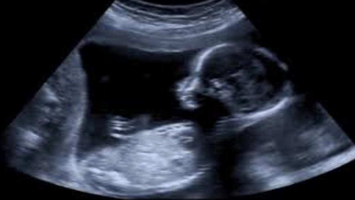 Ultrasound image of male foetus touching genital