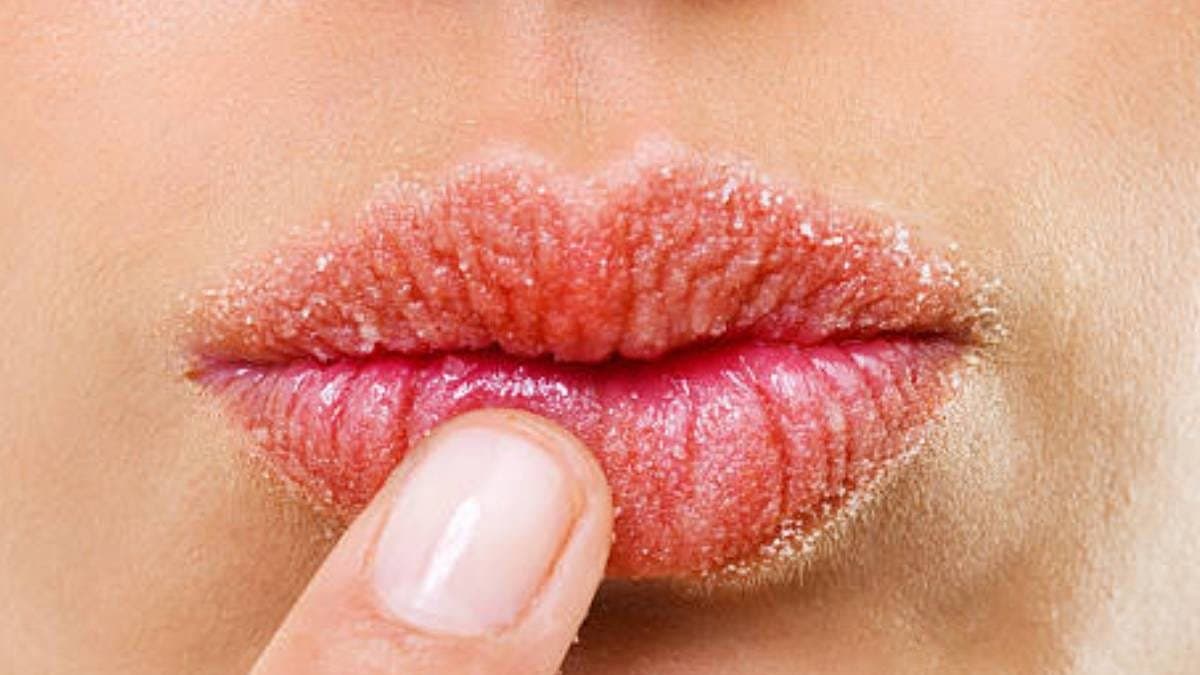 this home made natural remedy can prevent extreme dryness of your lips and make them soft smooth and beautiful lif