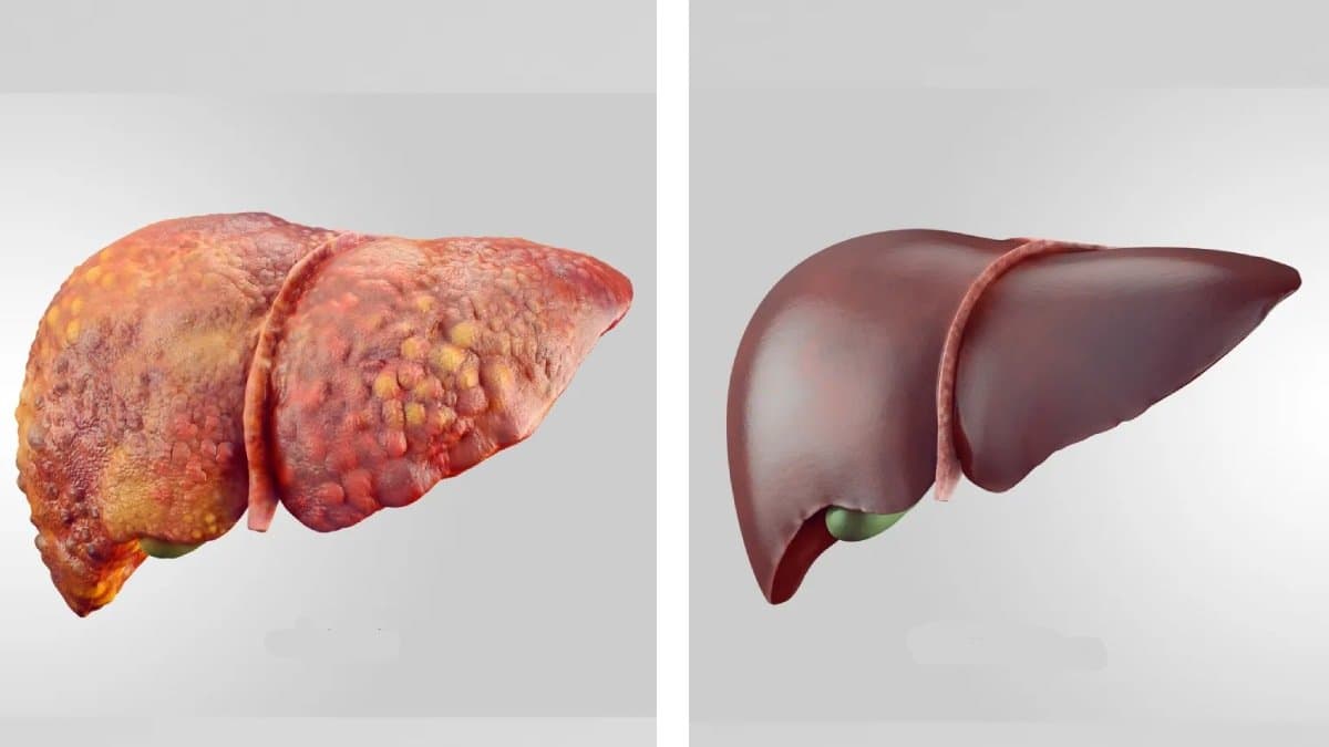 Make this drink to detox your liver