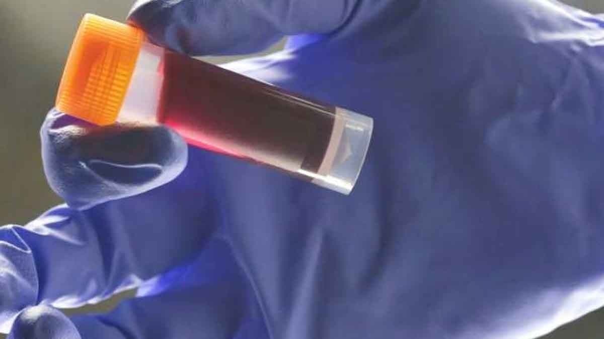 Your Blood Type Affects Your Risk of an Early Stroke gnr 