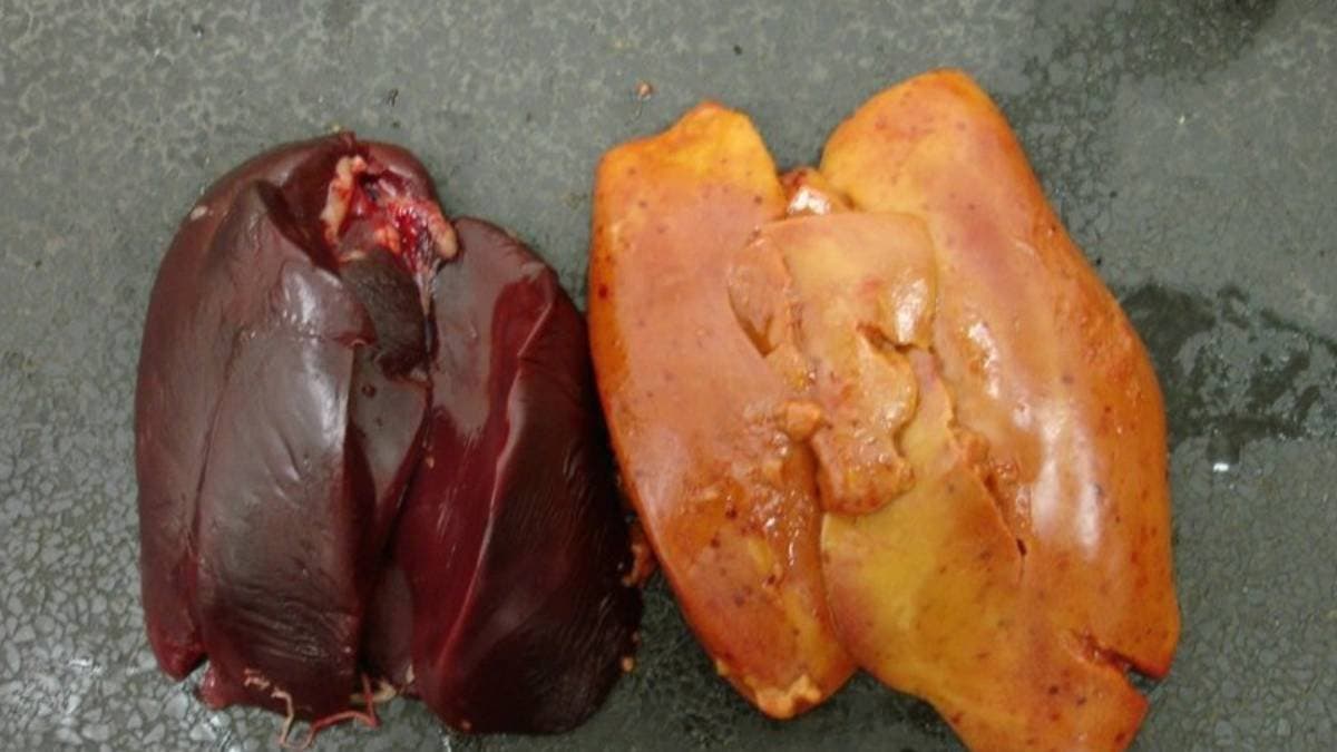 These snacks will revive fatty liver