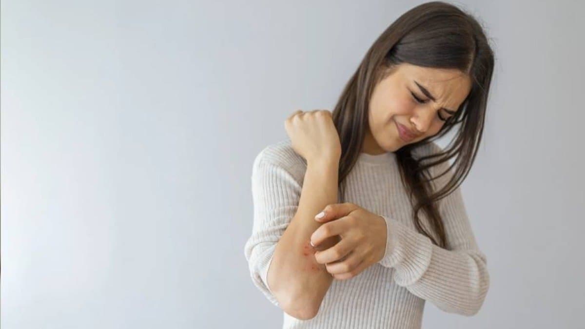 What vitamin deficiency causes dry  itchy skin here is all details lif 