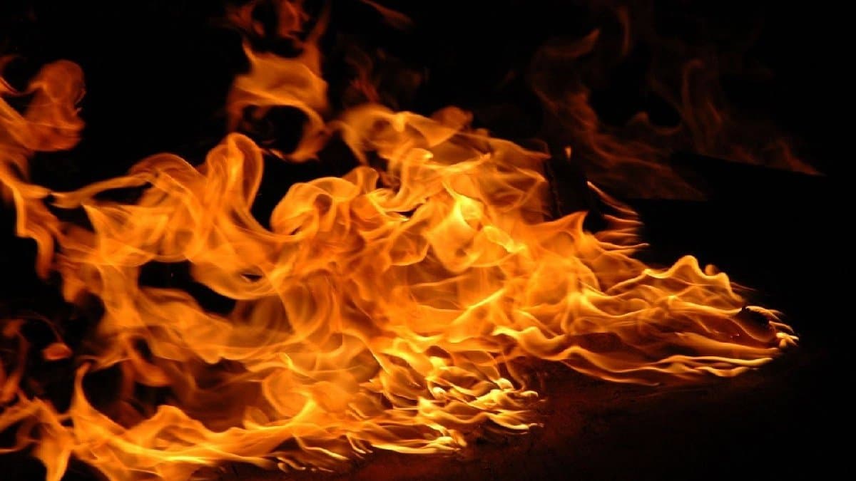 Girl Burned in Puri sources said teen Airlifted To Delhi Hospital