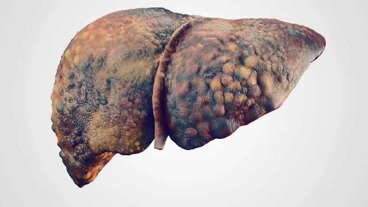 These foods and drinks are detrimental for Liver health