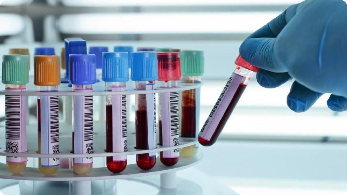 Scientists Identify worlds rarest blood group