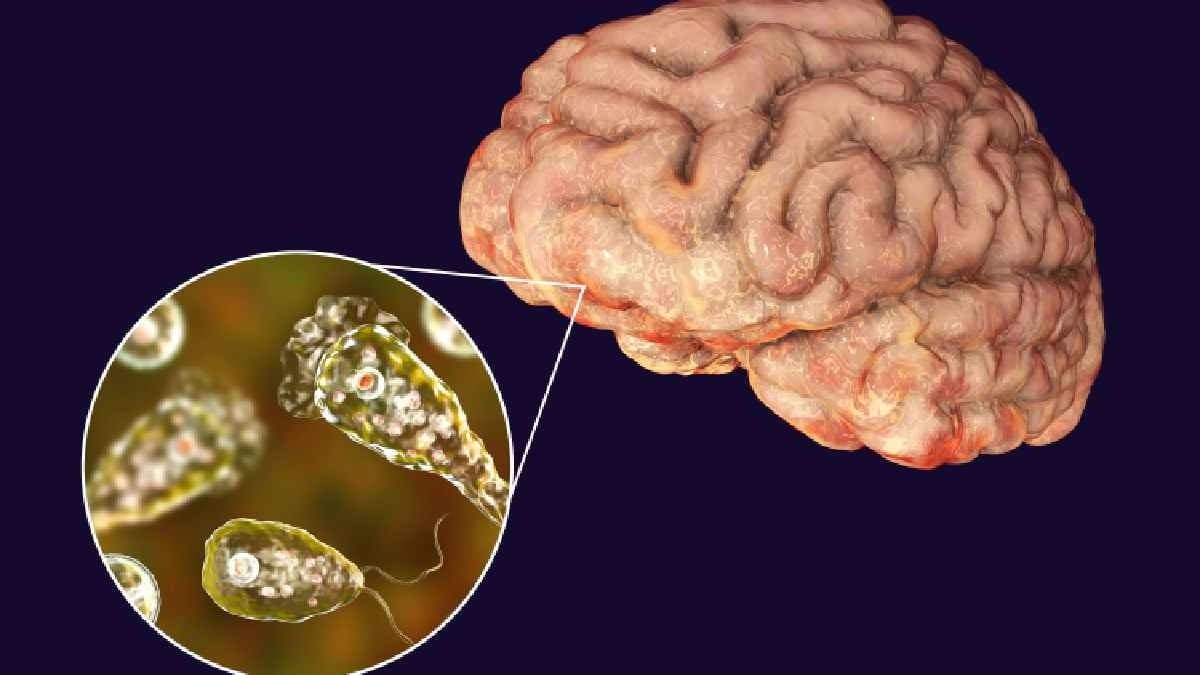 Brain eating Amoeba create Big Problem in Kerala