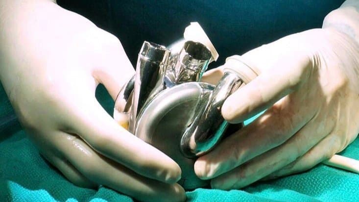 World's first heart made from Titanium keeps a man alive gnr 