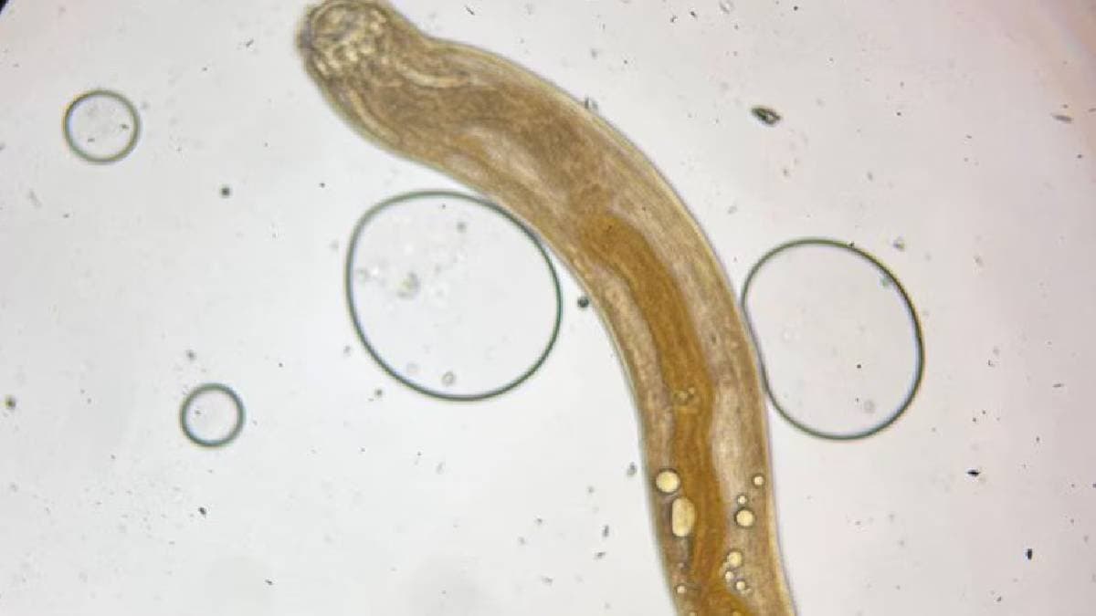 doctors at bhopal aiims surgically remove 1 inch long live insect from man eye
