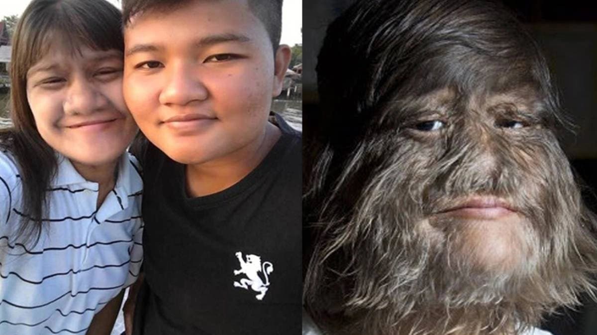 Worlds most hairy woman in thailand