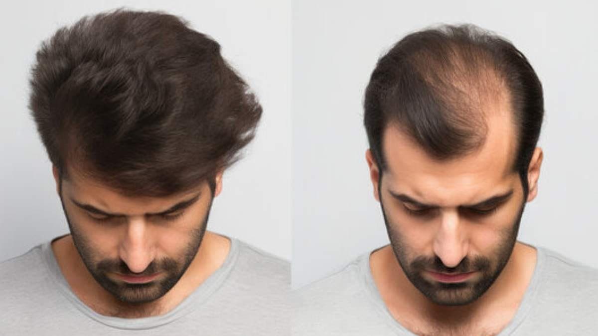  this home made natural hair mask can easily stop hair fall problem and helps to grow new hair make your hair thick long and black also lif 