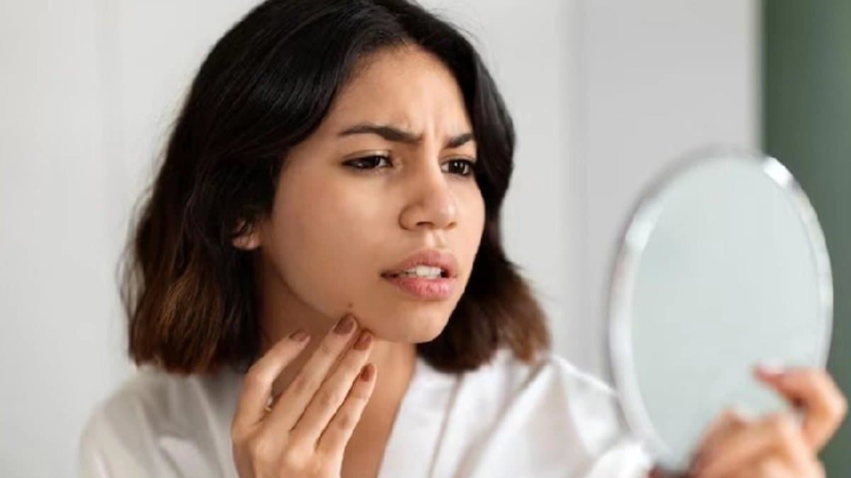 Skin Care Tips These foods help to prevent dry skin in winter