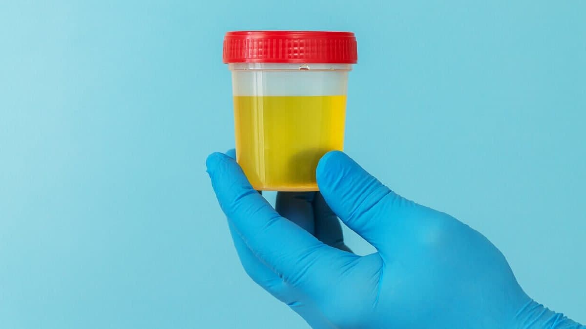 Scientists discover a way to convert urine into bone and teeth