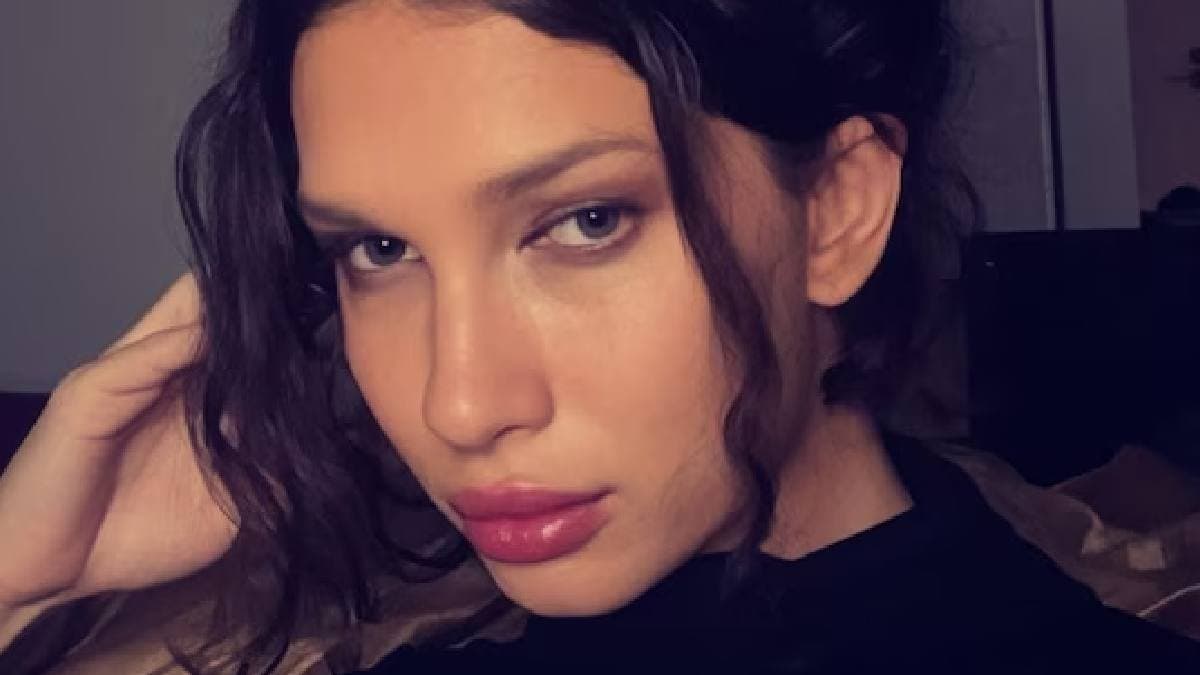  Australian Woman Spent Rs 6 Lakh On Cosmetic Procedures for getting cat face