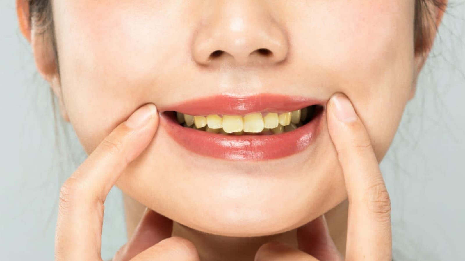 how  to whitening yellow teeth lif