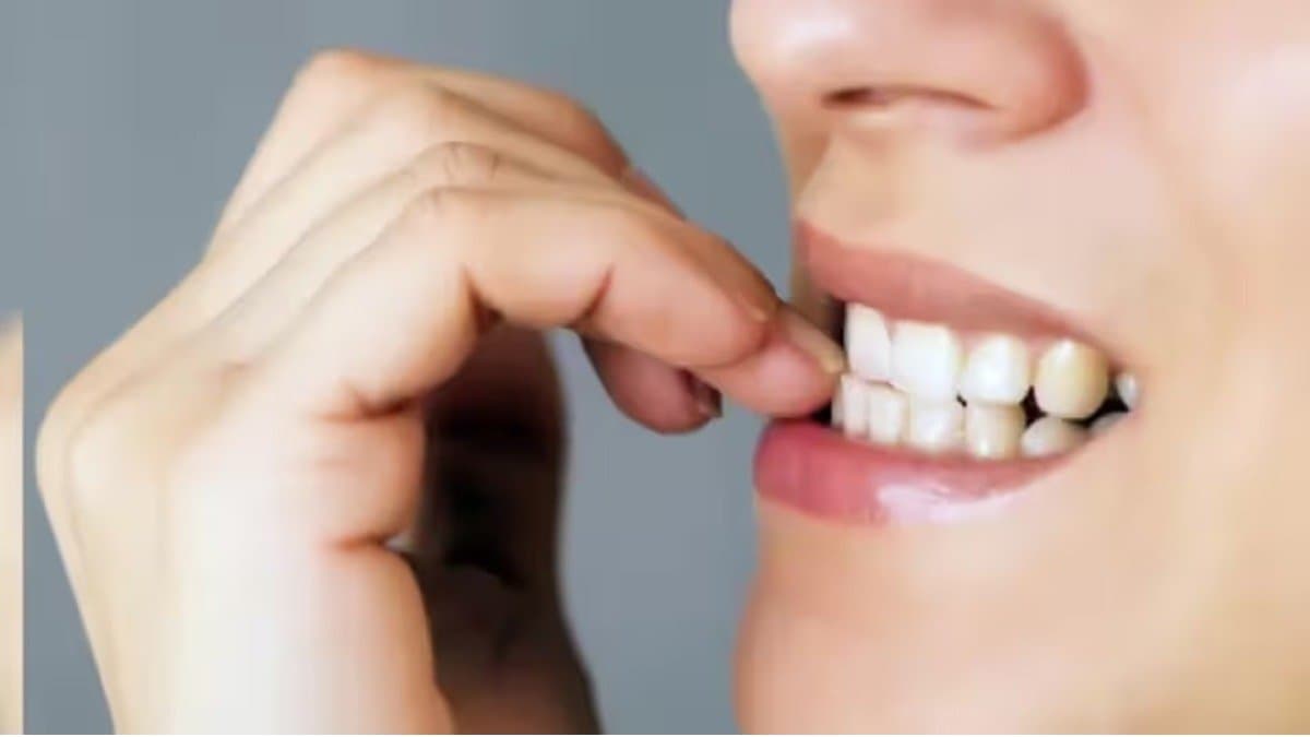  What are the side effects of biting nails things you should know details inside lif