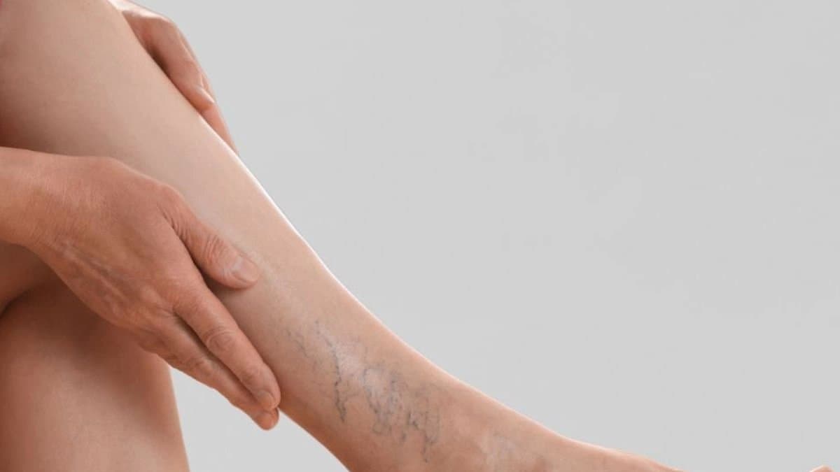 Four Leg Symptoms May Be the First Warning Signs of a Pancreatic Cancer