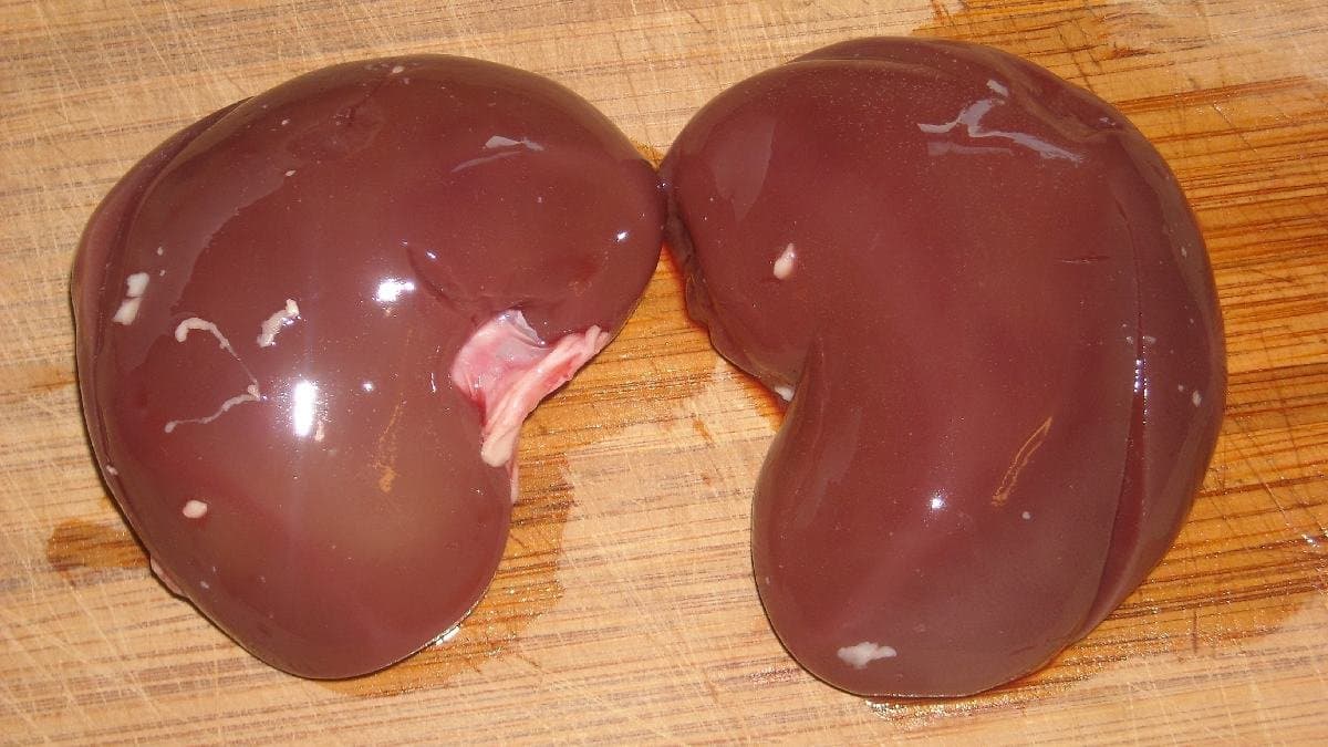 Mother donates kidney to save her son