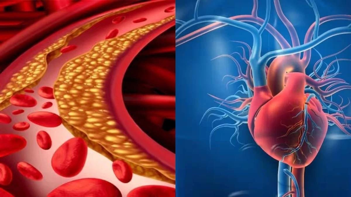 Amla health benefits: Gooseberry lower bad cholesterol and and support heart health