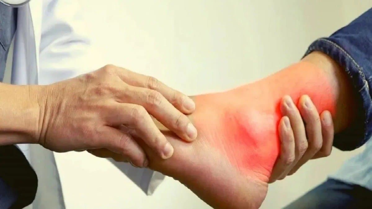 By drinking this drink every morning on empty stomach uric acid will be eliminated in 21 days 