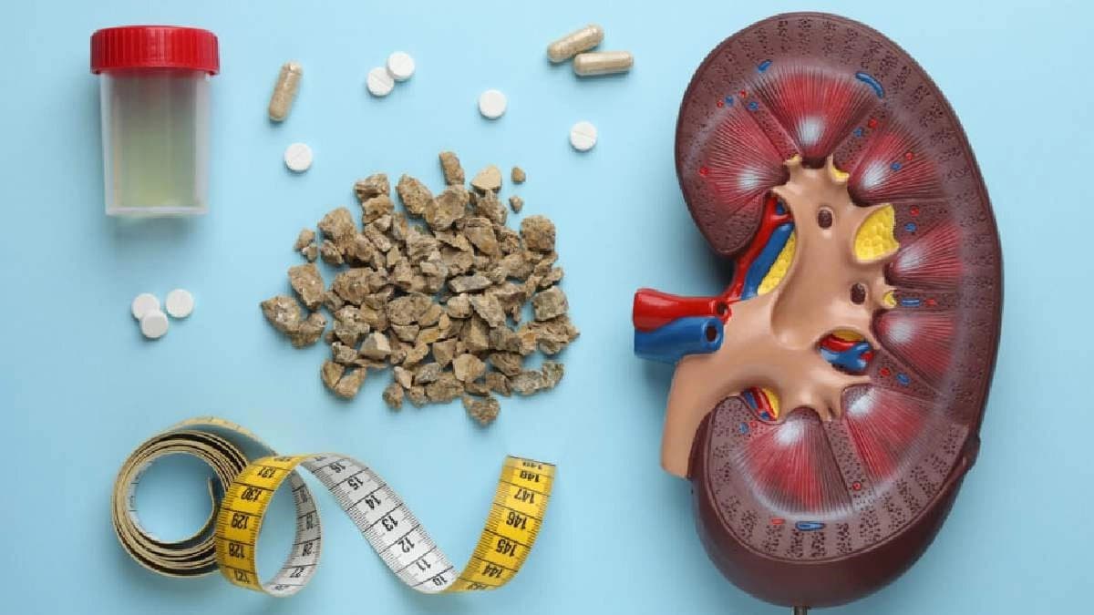 Avoid these Daily foods to reduce kidney Stone chance