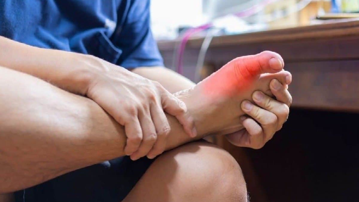 These natural remedies help to reduce uric acid levels