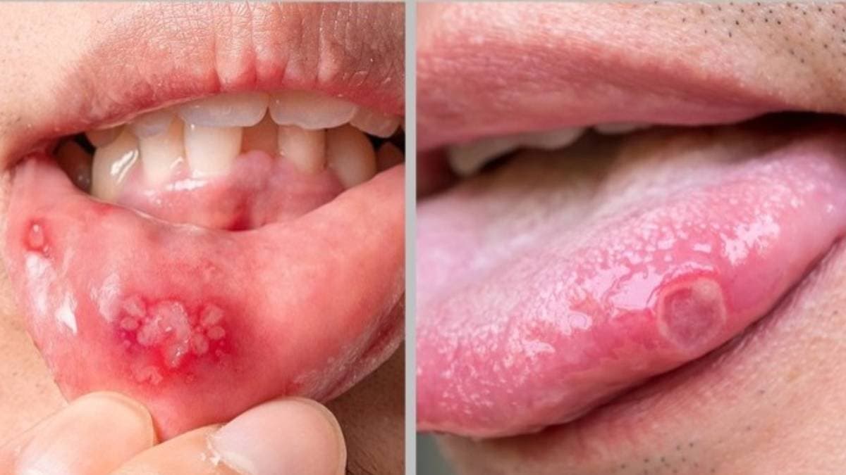 These symptoms of your mouth can indicate critical health problems