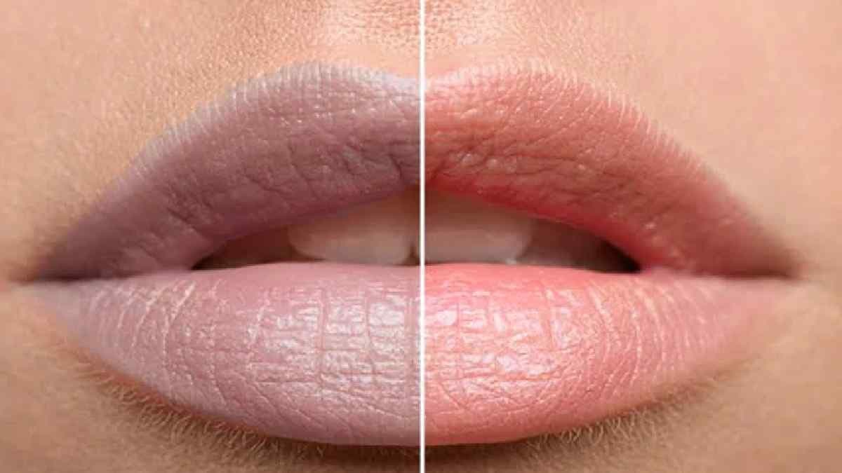 Lip Pigmentation: Three easy ways to make your lip colour pink