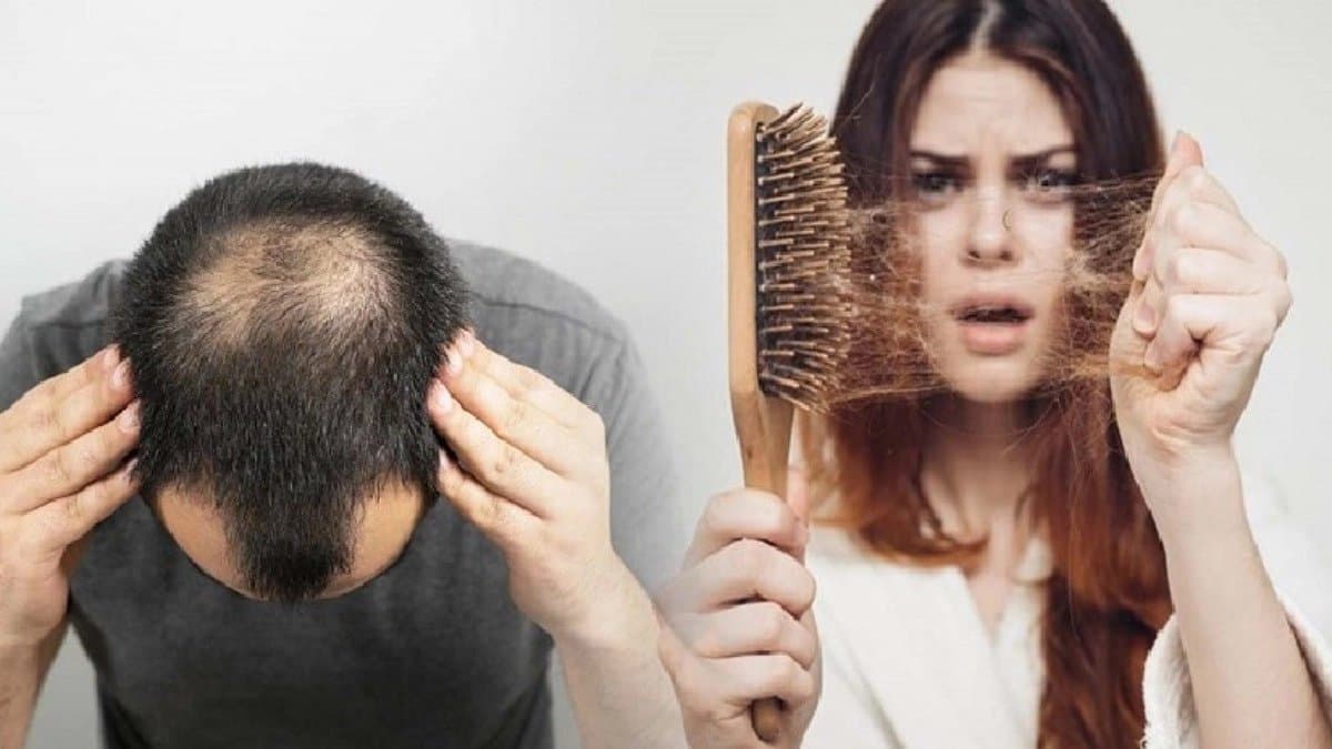 These herbal remedies help to prevent hair loss
