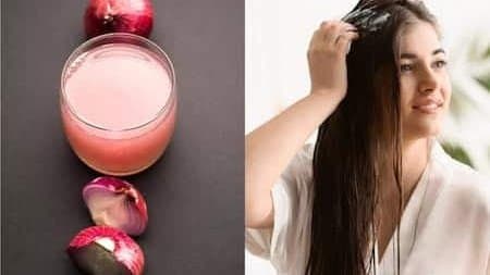 Seven Effective Uses of Onion Juice to Combat Excessive Hair Loss