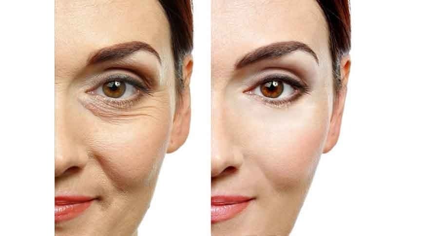 Coffee can improve your sagging skin tightened and make your skin wrinkle free lif