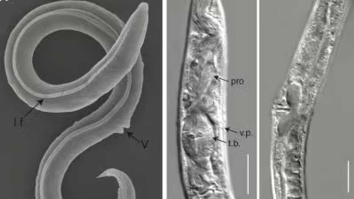 DNA of Earthworm is changing for the evolution of Earth