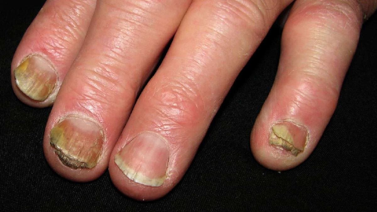 Tulsi leaf can heal your broken nails