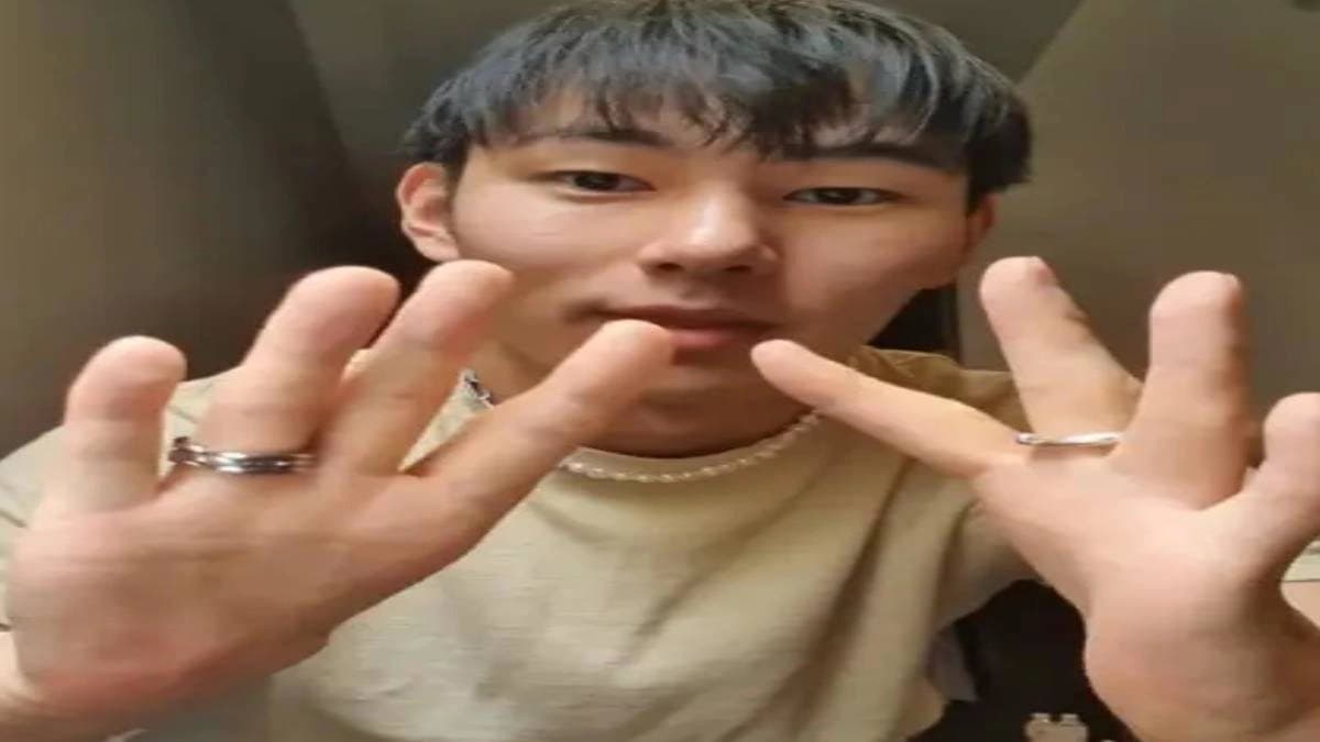 Thumbless man amazes internet with his hand job