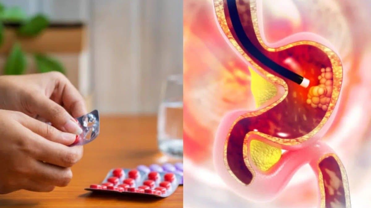 These two spices of your kitchen help to reduce gas acidity problem instantly