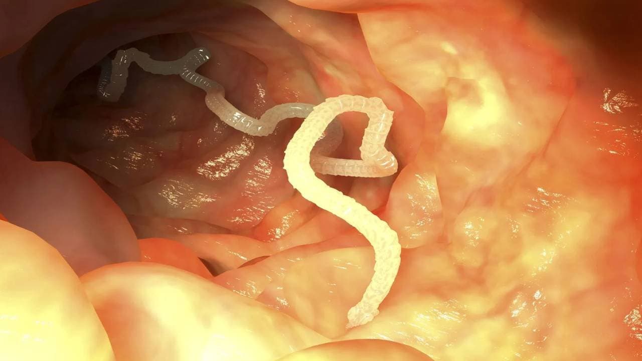 Avoid these vegetables as these contains tape worm