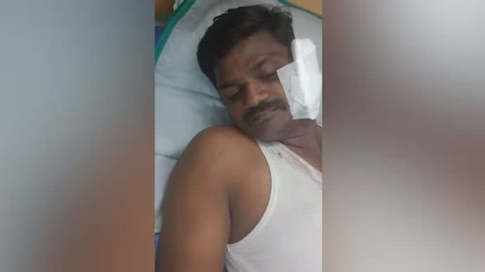 Police injured at tamilnadu
