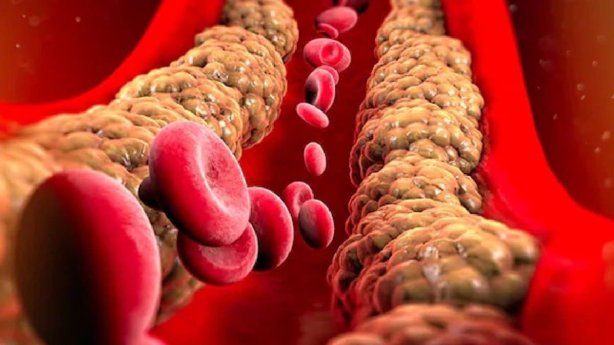 These cooking mistakes increase cholesterol and risk of heart attack